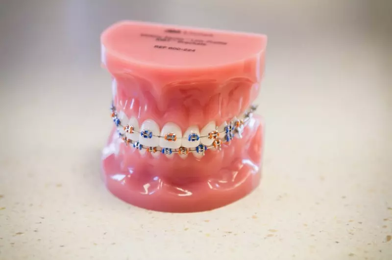 A model of teeth with braces on them.